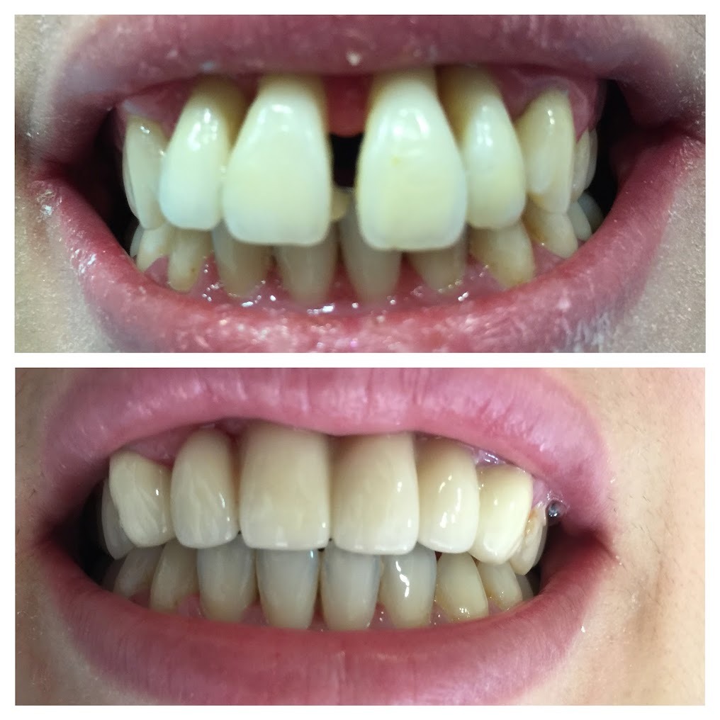 Transformation dentaire 1