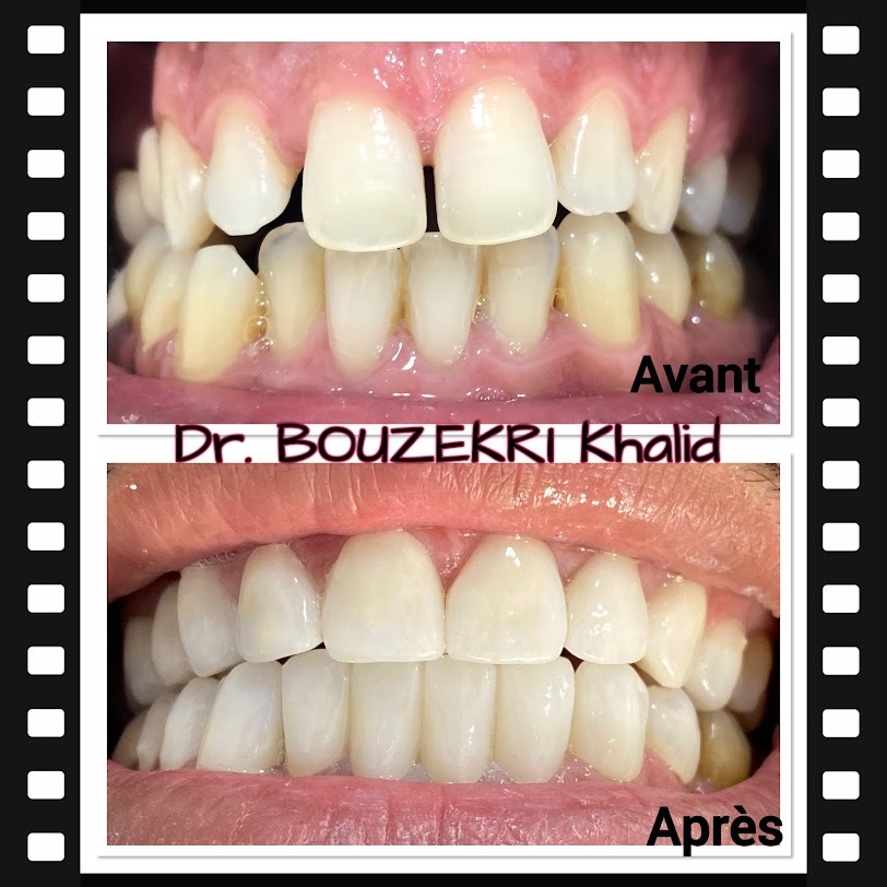 Transformation dentaire 2